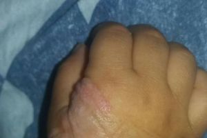 „Mi-au nenorocit copilul!”, e strigătul disperat al unei mame! A publicat poze şocante cu ce i s-a întâmplat în  spitalul din Videle. Alte femei au arătat şi ele poze cu copiii lor! E inuman şi „fără scuză!”. 