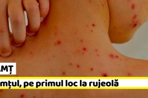 NEAMȚ: Neamţul este pe primul loc în topul judeţelor cu rujeolă