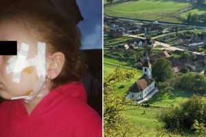 FOTO Fetiţă muşcată de faţă de un câine – Familia se revoltă: „Copila mea era să moară!”