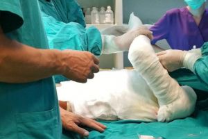 Unitate pentru arşi cu patru paturi, la Spitalul Judeţean din Focşani