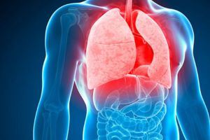 Duminică este Ziua mondială de luptă împotriva tuberculozei (TB) 2019