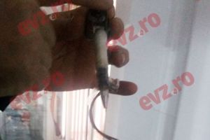 Aparatul de tatuat şi „găleata de ţuică”, material didactic