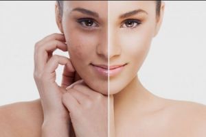 Sfaturi pentru o piele frumoasă! Femeile +30 de ani trebuie să ştie aceste trucuri
