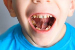 Unii părinţi uită de importanţa igienei orale. 6 milioane de copii români au învăţat la şcoală cum să se spele pe dinţi!