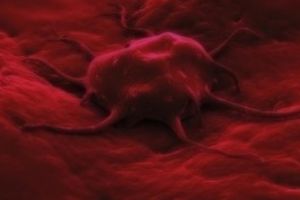 Inginerii români revoluţionează industria medicală - Software care detectează cancerul înainte ca boala să debuteze