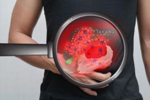 Timişorenii pot verifica, GRATUIT, dacă suferă de hepatită C. Cei bolnavi primesc şi tratament şi nu au nevoie de trimitere de la medicul de familie