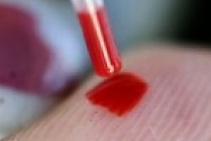 Bolnavii de cancer, condamnati la indiferenta! Planul National de Control al Cancerului, niciodata adoptat de Guvern