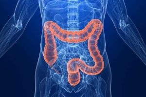 Rezecţiile colo-rectale laparoscopice, în cancerul de colon sau rect