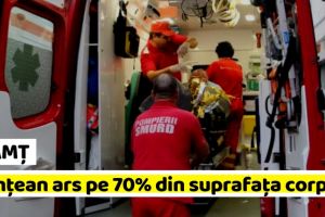 NEAMȚ: Nemţean ars pe 70% din suprafaţa corpului, transferat în Italia