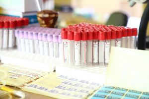 Donatorii de sânge nu vor mai primi bonuri de masă. La Timişoara donează ”oamenii educaţi”