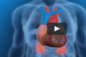 Atac de cord. Cum ne putem salva viaţa într-o situaţie critică? Sfaturi vitale