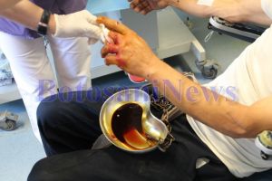 Caz mai puţin obişnuit! A ajuns la Urgenţe pentru a i se tăia …. verigheta