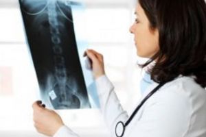 Osteoporoza – provocarea trecerii timpului