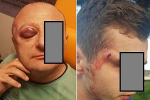 FOTO Ce a păţit un bărbat care a luat apărarea unui tânăr agresat pe stradă. Amândoi au ajuns la spital cu răni grave