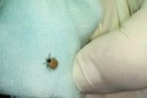 Luna căpuşelor la spitalul din Lugoj! Zeci de persoane muşcate de insecte au ajuns la urgenţe în luna mai