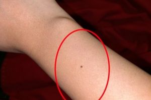 Tu ai aluniţă pe încheietura mâinii? Verifică chiar acum! Mii de oamenii din toată lumea şi-au dat seama că au aceeaşi aluniţă. Care e explicaţia