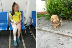 FOTO Starea fetiţei muşcată de câine – Părinţii se tem pentru că animalul este încă liber