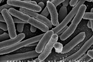 Bacteria E-Coli, găsită în apa de la Spitalul Judeţean Vaslui. Primele măsuri