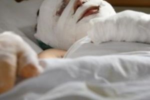 Caz grav la Timişoara. O pacientă cu arsuri grave a fost obligată să plătească transportul la Viena