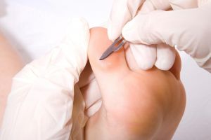 Meseria de podiatru, o necesitate în România