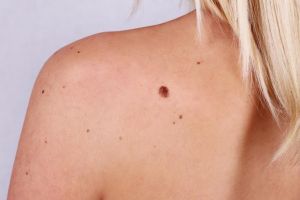 Singura boală care nu doare deloc, dar poate să ucidă în mai puţin de un an