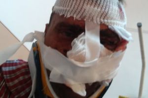 FOTO A încasat o bătaie soră cu moartea! Botoşănean desfigurat de un consătean