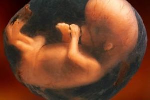 Avortul, interzis! S-a terminat! Medicii din România refuză să facă avort la cerere!