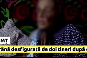 NEAMȚ: Bătrână desfigurată de doi tineri după ce le-a atras atenţia să nu-şi mai facă nevoile la poarta ei