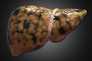 7 sfaturi pentru detoxifierea ficatului