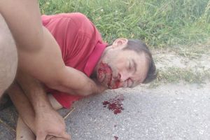 Bărbat desfigurat în bătaie de doi copii care nu au încă 14 ani, dar care au terorizat sate întregi din judeţ