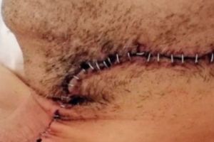 Șocant! Un chelner român e încă liber pe străzi după ce i-a tăiat jugulara şefului care-l concediase.