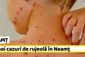 NEAMȚ: 23 noi cazuri de rujeolă în Neamţ, în ultima săptămână