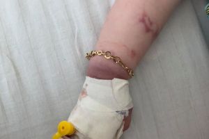 FOTO Copilaş chinuit în spital. Mama acuză că fetiţa a fost tratată „într-un hal animalic”