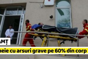 NEAMȚ: Femeie în stare gravă, cu arsuri pe 60 % din suprafaţa corpului