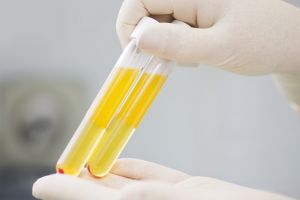 Sorina Pintea: ”Suntem destul de înaintaţi, astfel încât să putem colecta plasmă”