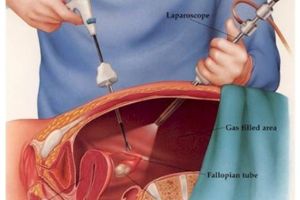 Șase laparoscoape performante, în dotarea Spitalului Judeţean Târgu Mureş