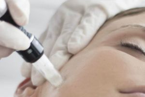 DSP Dâmboviţa: Mezoterapie cu ace (microneedling-ul), interzisă în saloanele de înfrumuseţare