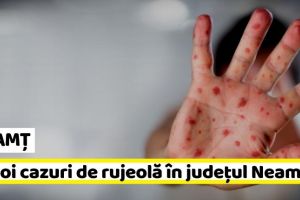 NEAMȚ: 15 noi cazuri de rujeolă în judeţul Neamţ, în ultima săptămână