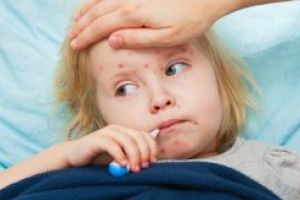 Alte 129 de cazuri de rujeola au fost inregistrate in ultima saptamana in 14 judete si Bucuresti