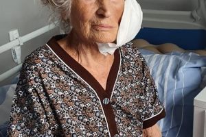 O tumoră gigantă de la nivelul feţei, operată cu succes la o pacientă de 95 de ani