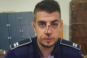 Poliţist cu nasul spart de un smecher din Balş care este suspect de tâlhărie