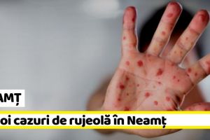 NEAMȚ: 16 noi cazuri de rujeolă în Neamţ, în această săptămână