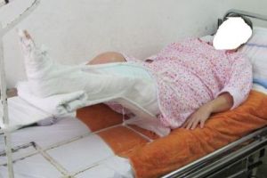 Şi-a bătut SOACRA până i-a rupt piciorul!