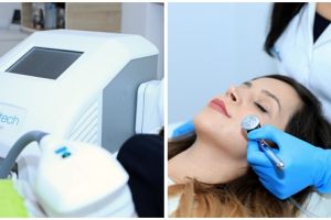 EstetPRO – Încredere, siguranţă, rezultate!