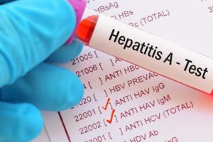 Tot mai mulţi hunedoreni diagnosticaţi cu hepatita A