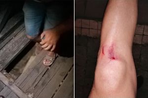 UPDATE| FOTO| Știrea ta: Un albaiulian s-a trezit că îi fuge pământul de sub picioare, după ce o bucată dintr-un pod de lemn s-a rupt