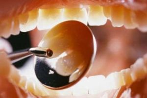 Un botoşănean şi-a înghiţit proteza în somn. A fost dus de urgenţă la Iaşi