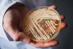Candida auris, ciuperca mortală amatoare de încălzire