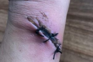 Imagine şocantă! Cum a fost operat un bărbat de către medici într-o unitate de primiri urgenţe