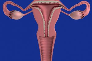 Chistul ovarian – tot ce trebuie să ştii